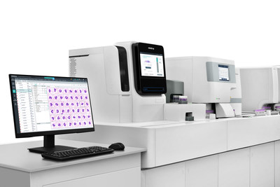 El analizador digital de morfología celular Mindray MC-80 ofrece más para el análisis morfológico.